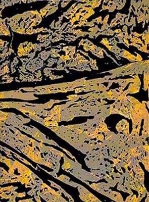 Lithographie de Hervé Bordas