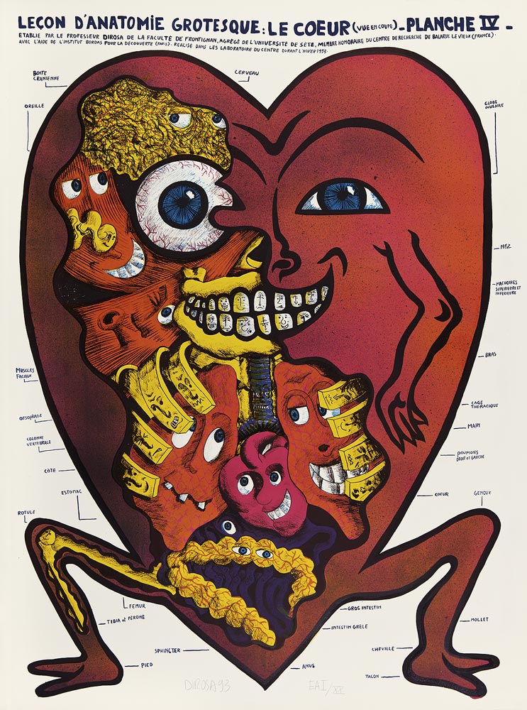 Hervé Di Rosa, Lithographie, -Leçon d-Anatomie grotesque-, 1993